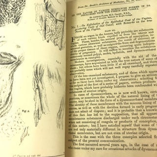 [MEDICINE] [WOMEN] [ABNORMALITIES] On the Nature of Various Substances Formed in and Discharged from the Uterus and Vagina; From Dr. Beal's Archives of Medicine, No II, 1858